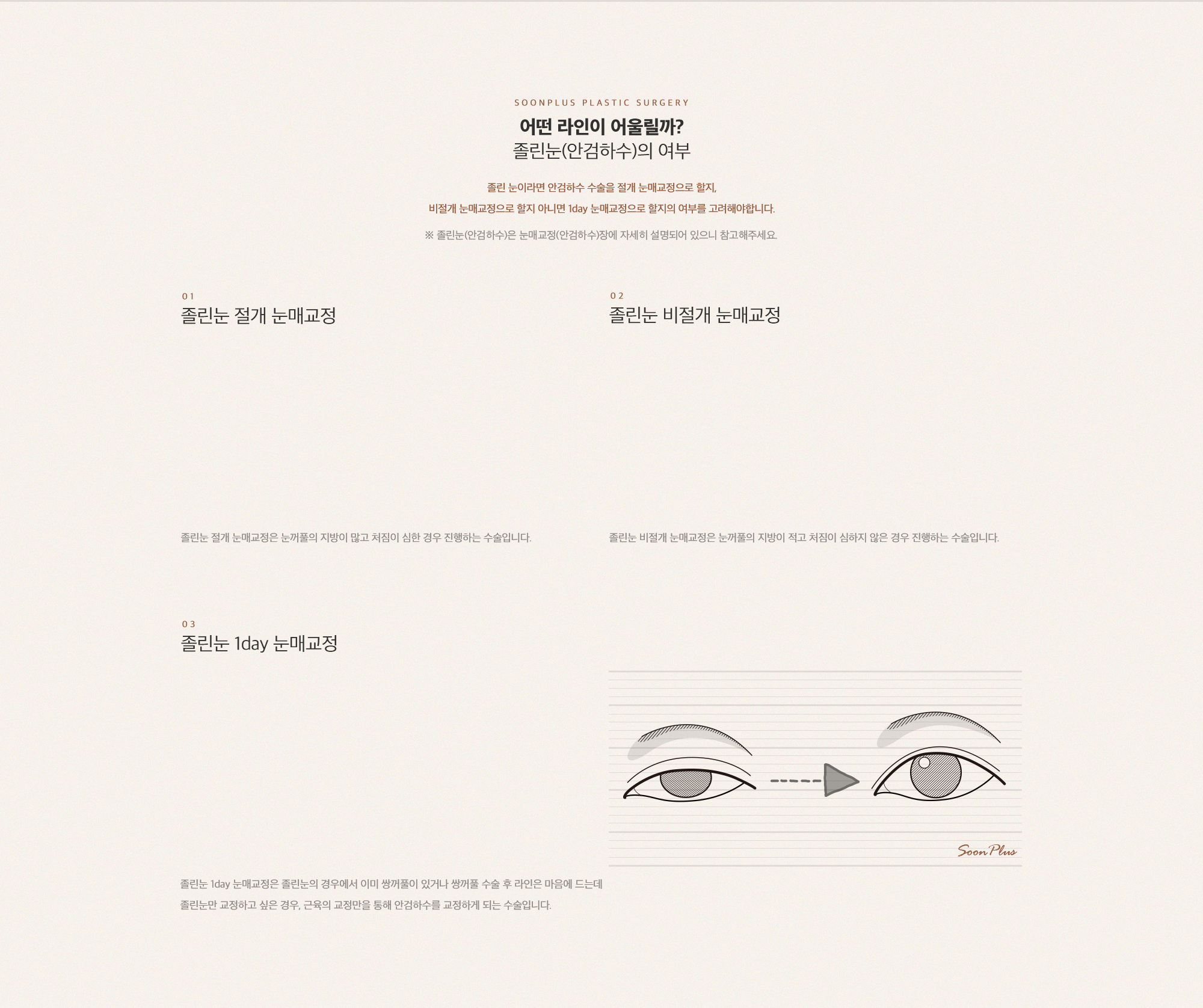 졸린눈(안검하수)의 여부