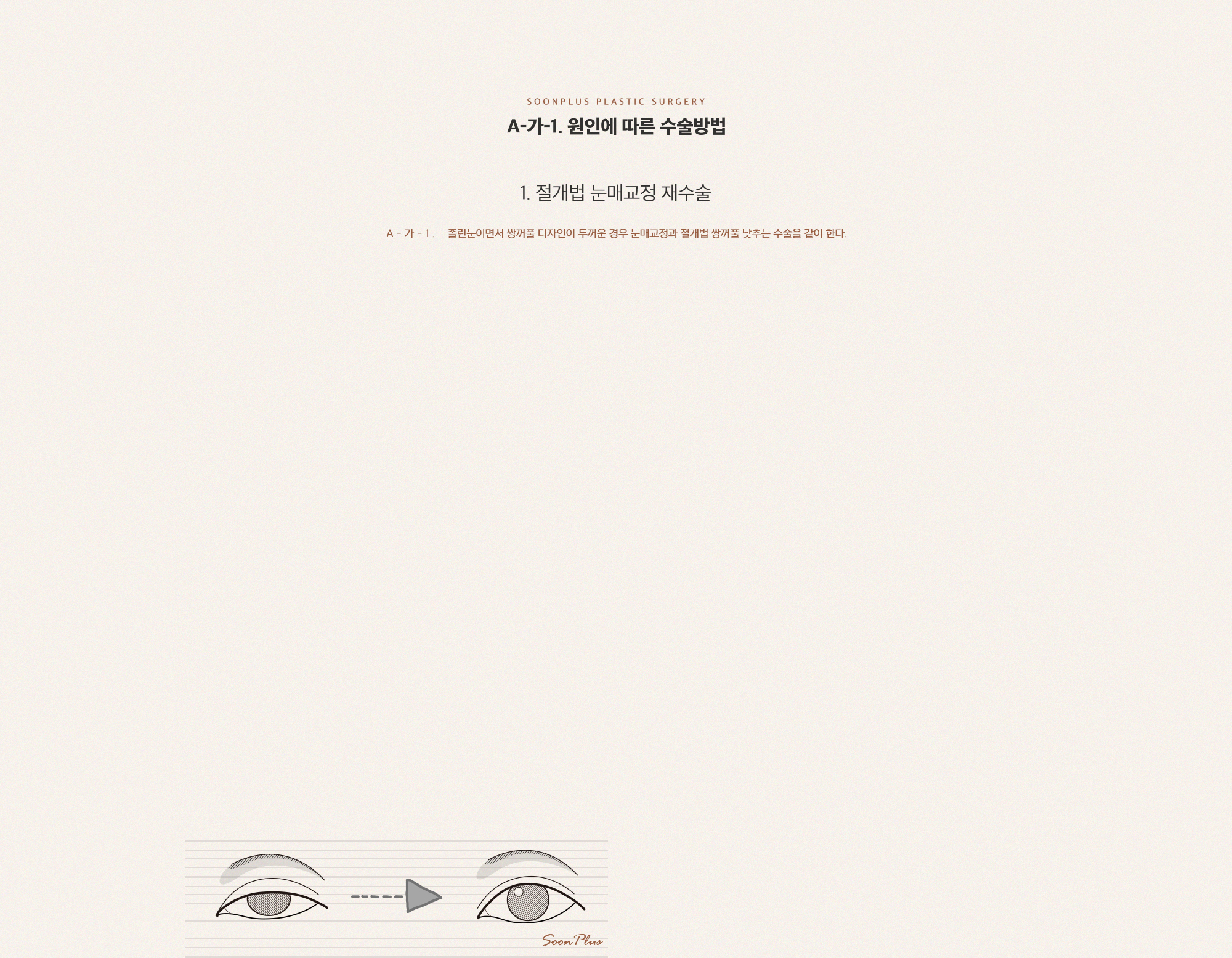 A-가 원인에 따른 수술 방법