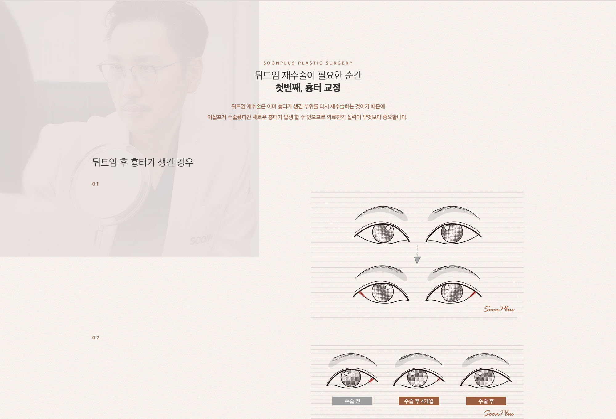 첫번째, 흉터 교정