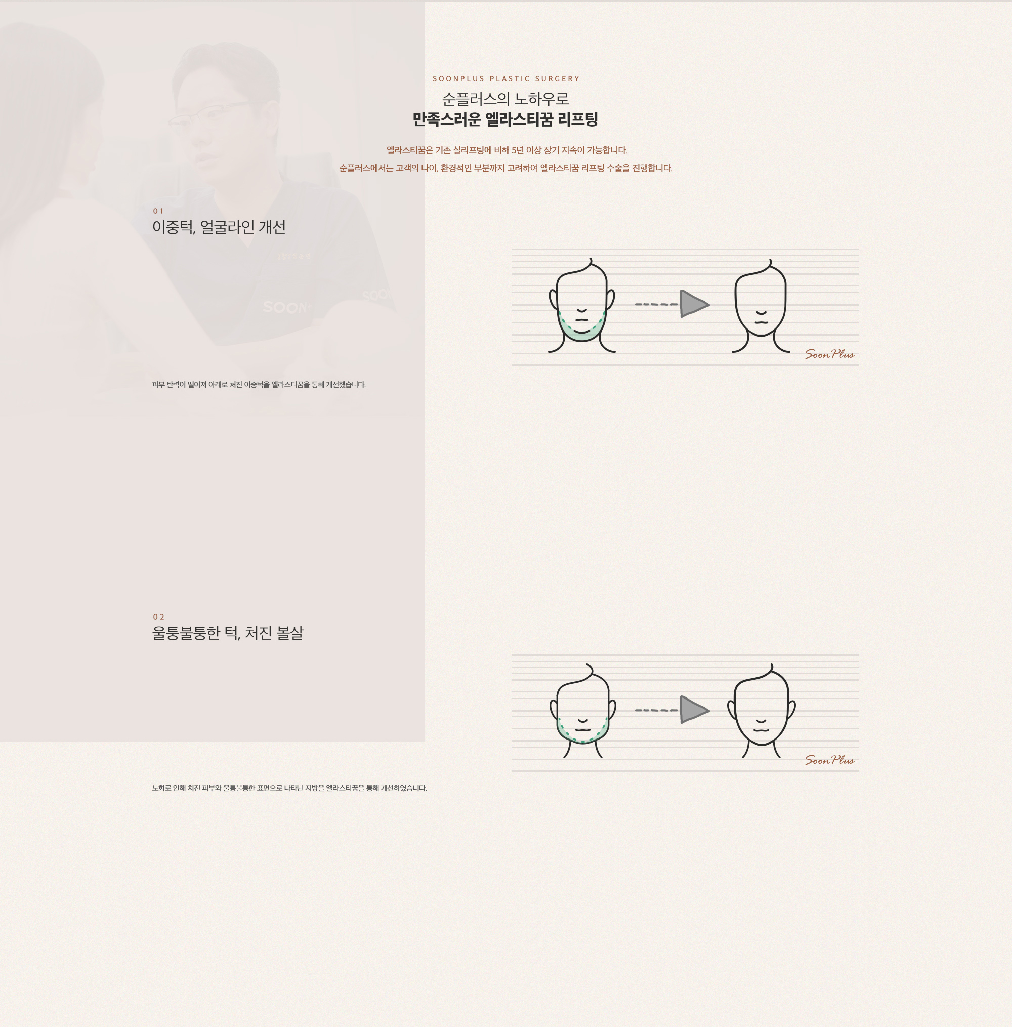 순플러스의 노하우로 만족스러운 엘라스티꿈 리프팅