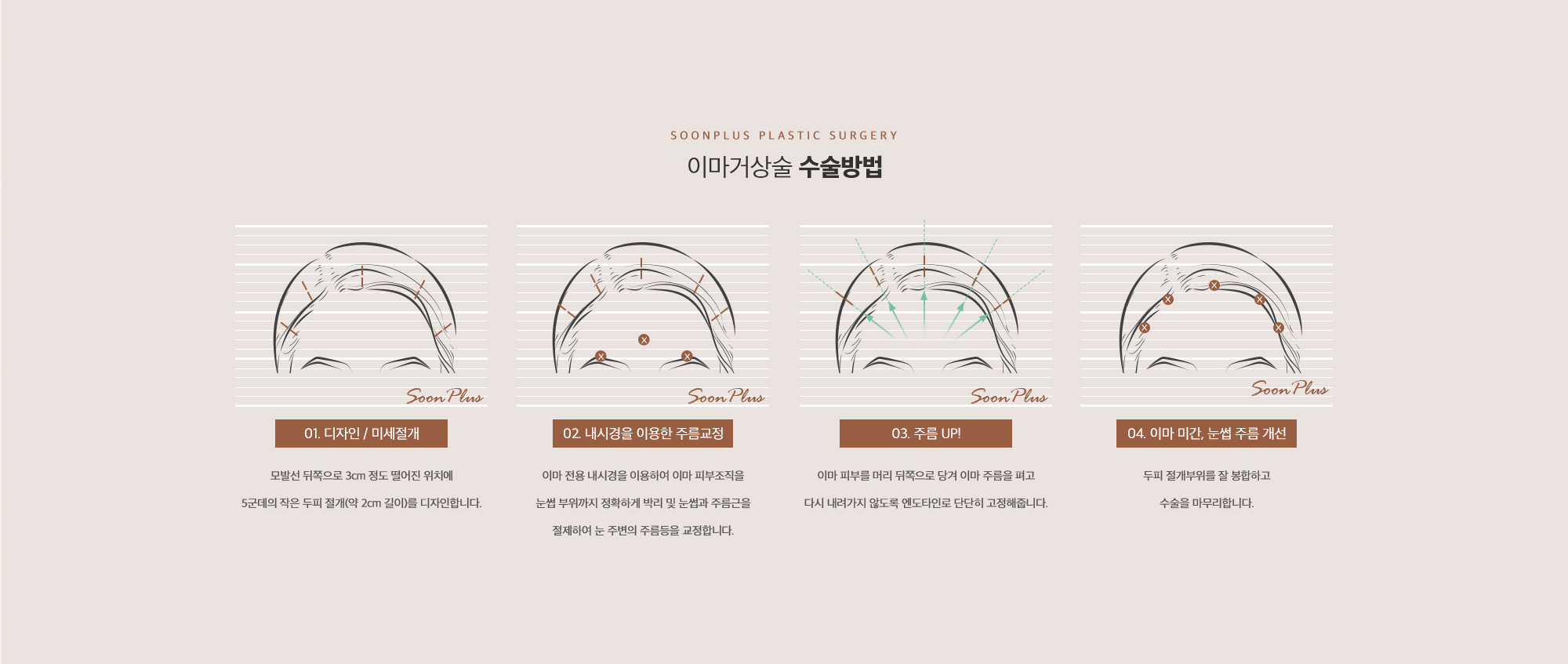 이마거상