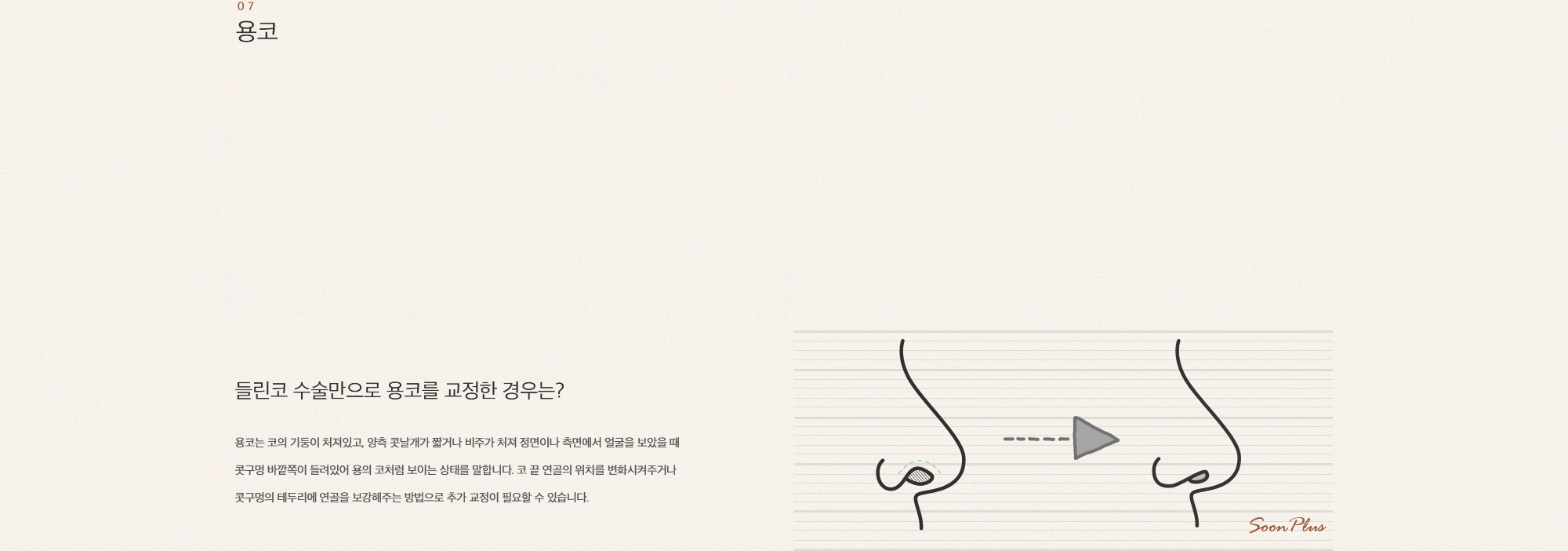 07 용코