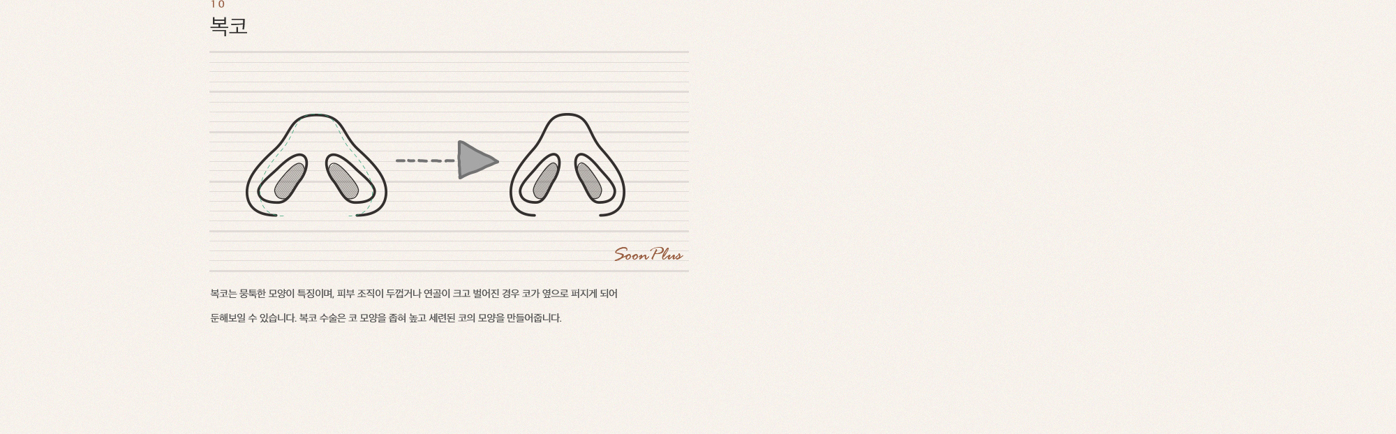 10 복코